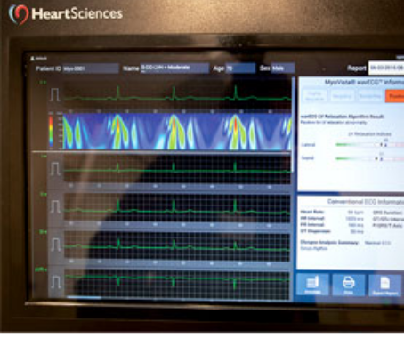 Cardiology-AI-Sidebar-Scr2-277x232