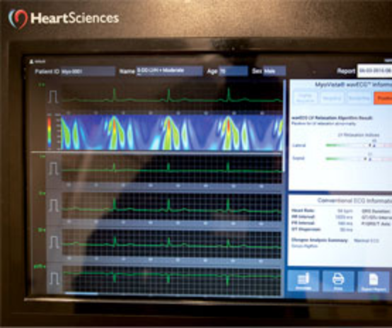 Cardiology-AI-Sidebar-Scr2-277x232