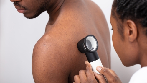 Close-up of a doctor checking the skin on a man's back