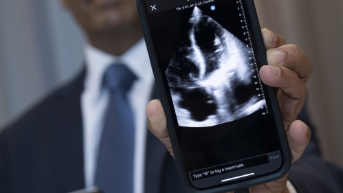 Dr. Sengupta shows the screen of a phone and the pocket ultrasound