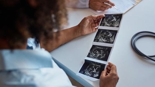 Image of woman with ultrasound image