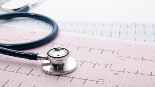 Photo of stethoscope and EKGs