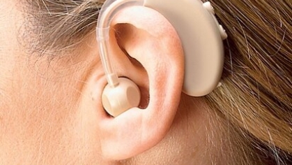 Image of a hearing aid in a patient's ear