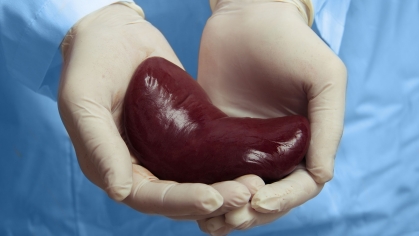 kidney in doctor's hands