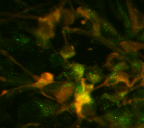Image of research from The Grosso Lab on the mechanistic role of autophagy in synapses